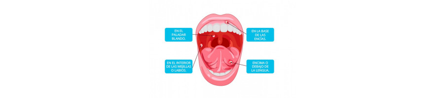 Aftas bucales » 【Herbodietetica Sport】